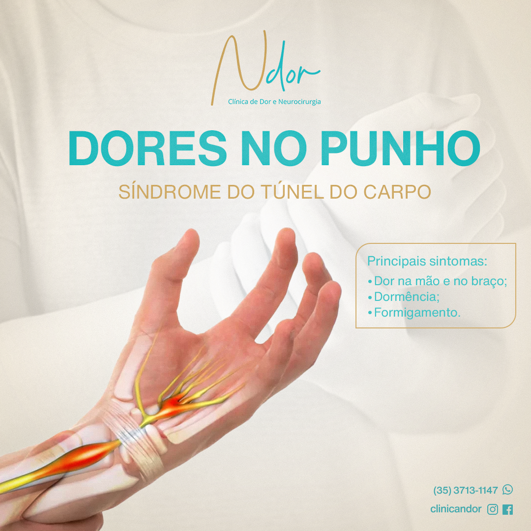 Dores no Punho: Síndrome do Túnel do Carpo