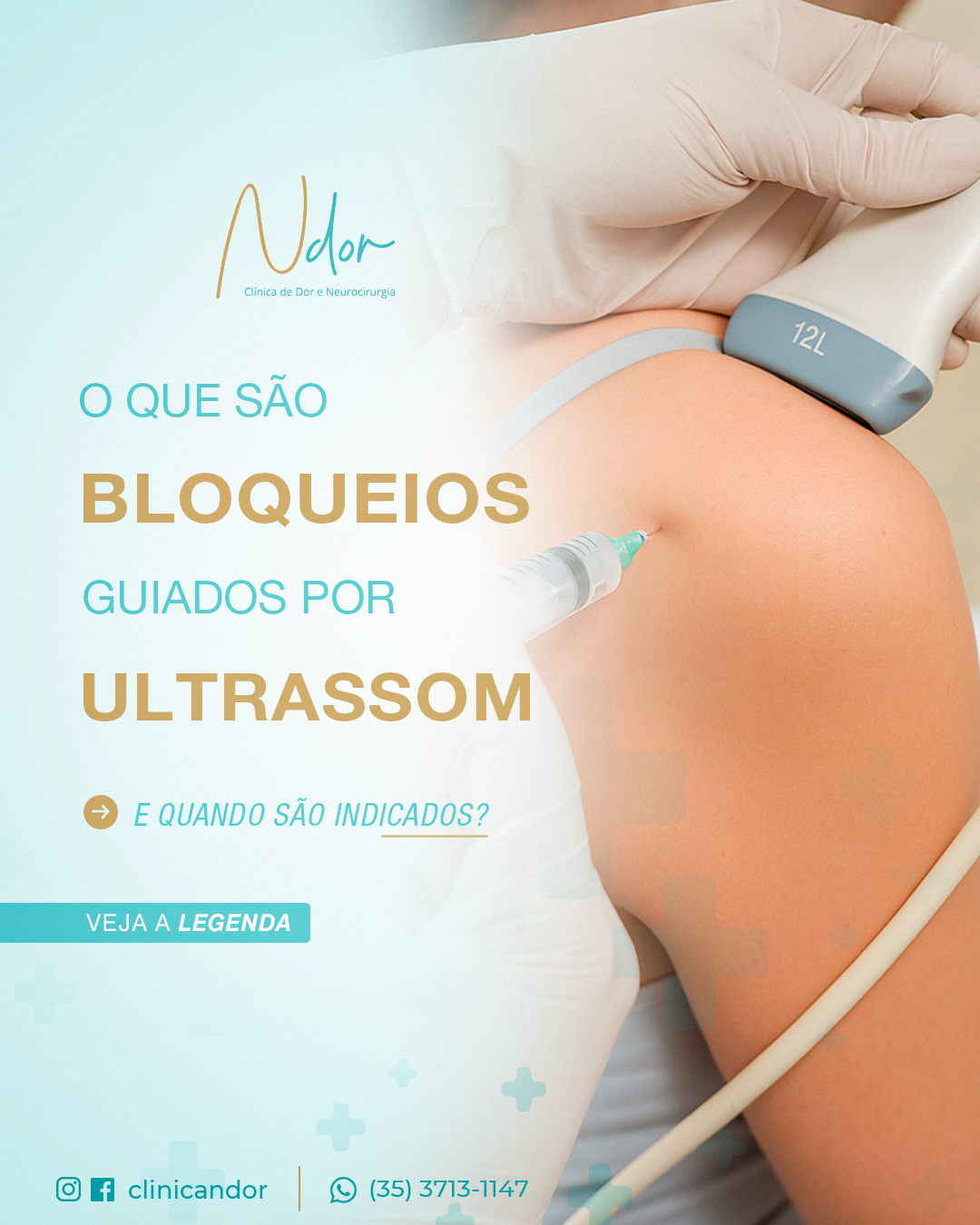 Você sabia que a tecnologia do ultrassom vem transformando o tratamento da dor de forma precisa e segura?