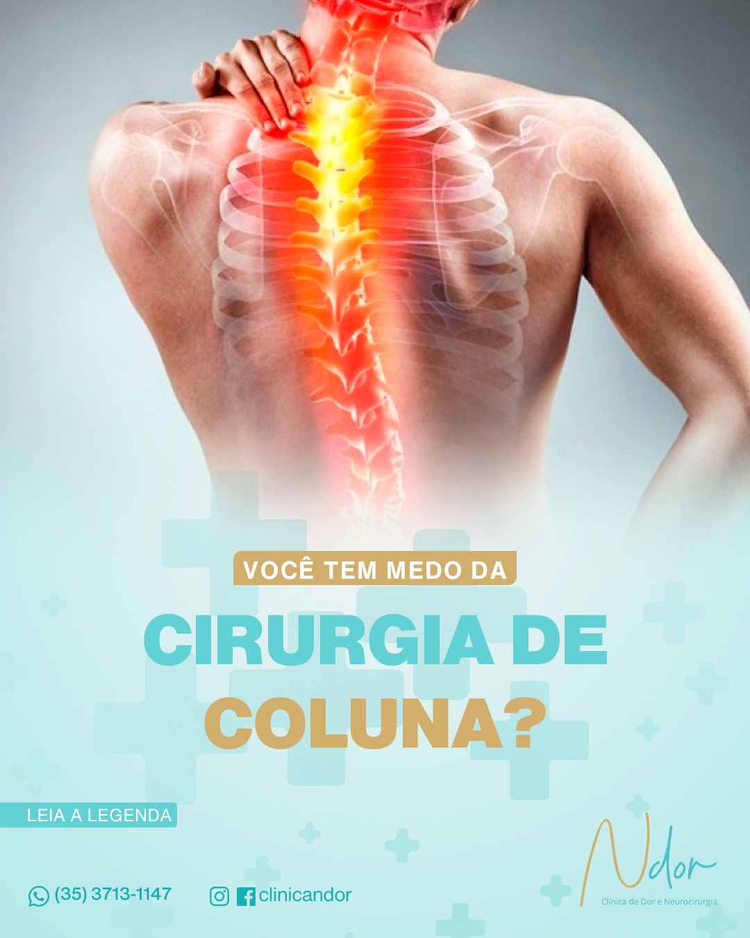Cirurgia de Coluna: mitos e verdades