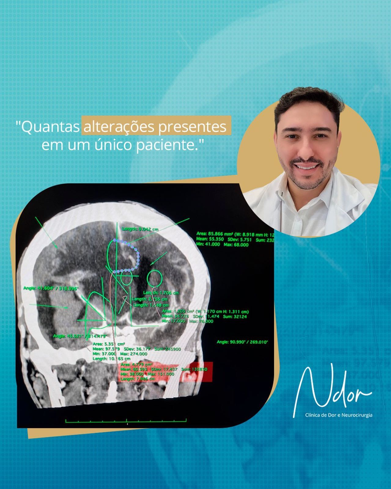 VEJA QUANTAS ALTERAÇÕES EM UM ÚNICO PACIENTE