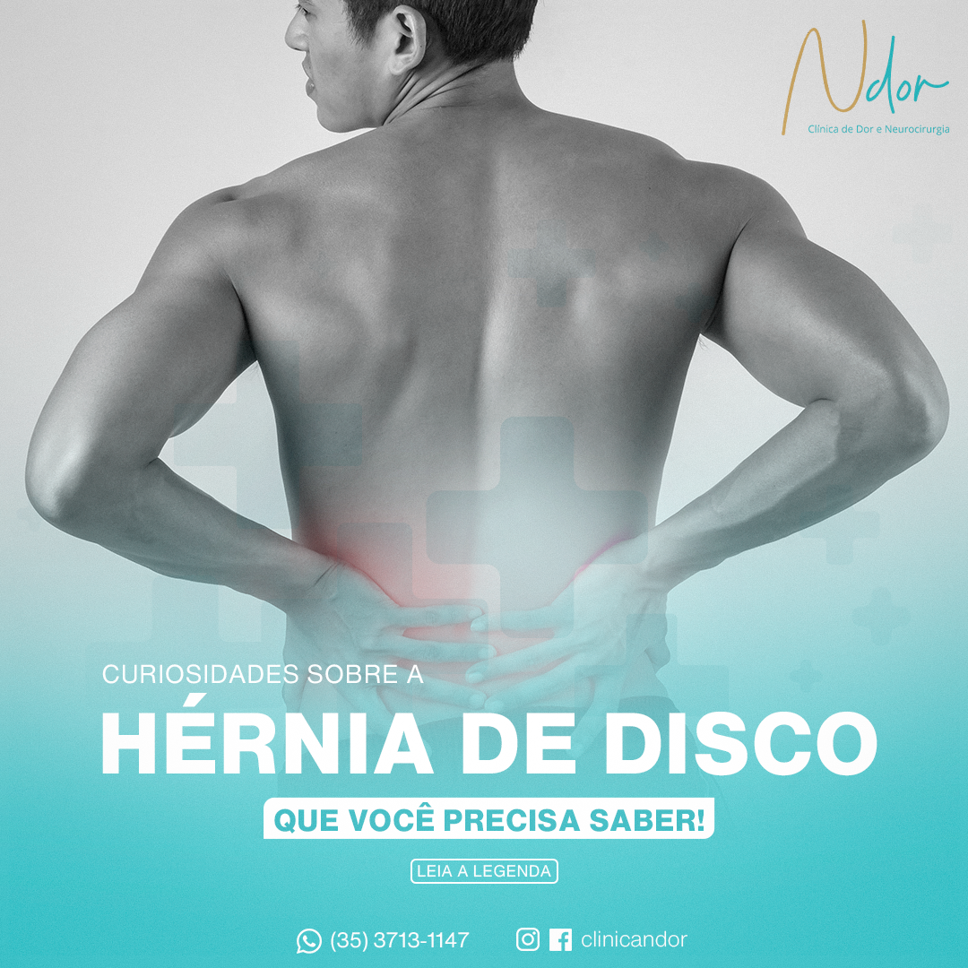 Curiosidades sobre a hérnia de disco, que você precisa saber!