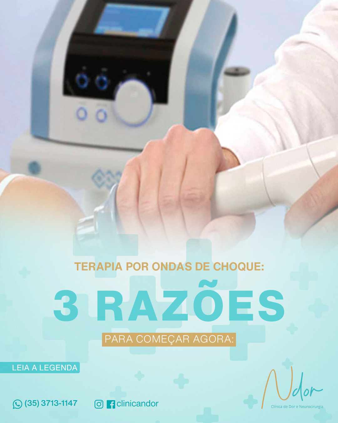 Terapia por Ondas de Choque: 3 razões para começar agora!