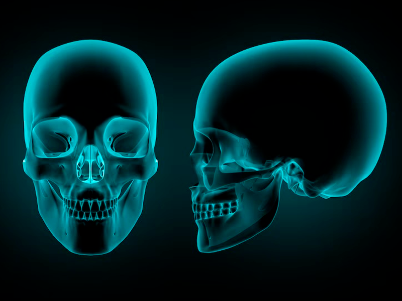 CIRURGIA DE BASE DE CRÂNIO