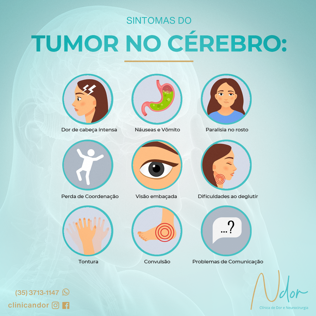 Sintomas do Tumor no Cérebro:
